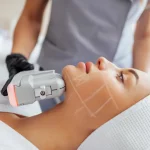 HIFU : Comment l’ultrason offre un lifting sans chirurgie et durable